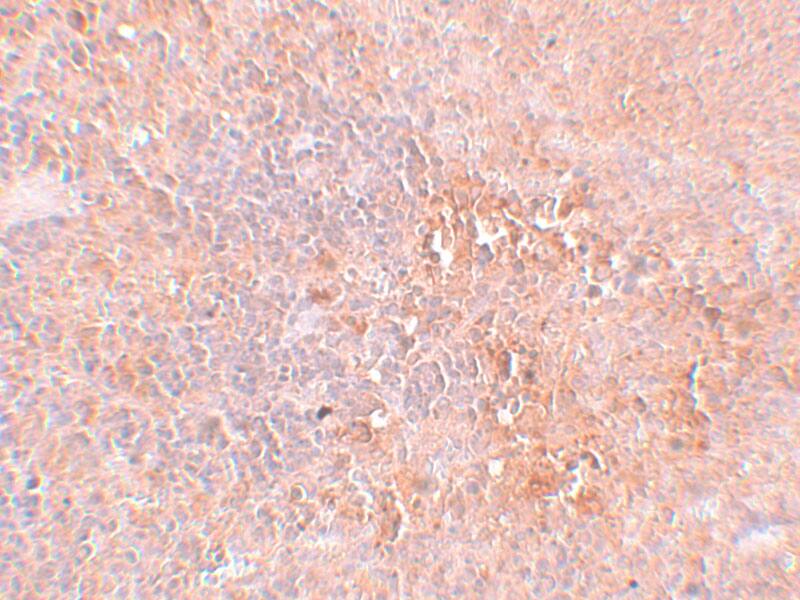 JMJD4 Antibody - BSA Free