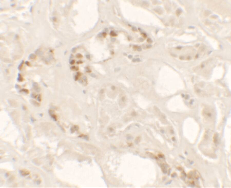 KANK2 Antibody - BSA Free