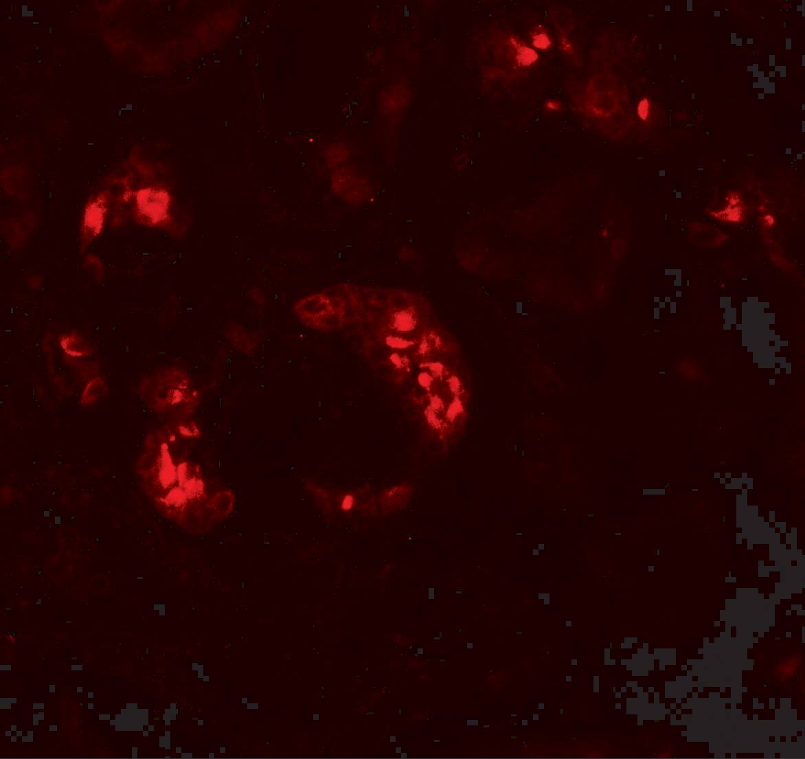 KANK2 Antibody - BSA Free