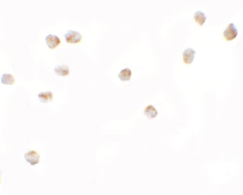 LEMD2 Antibody - BSA Free