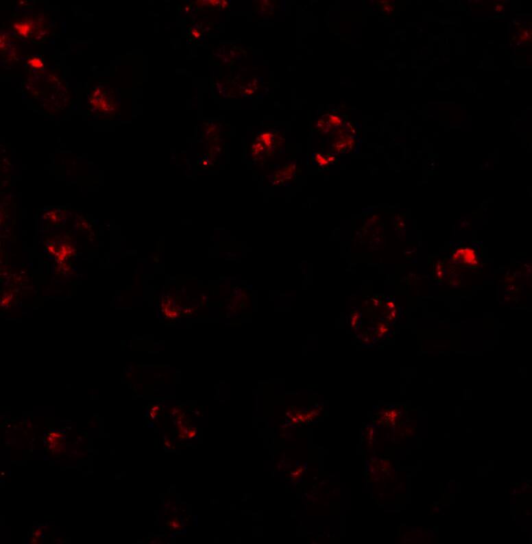 LEMD2 Antibody - BSA Free