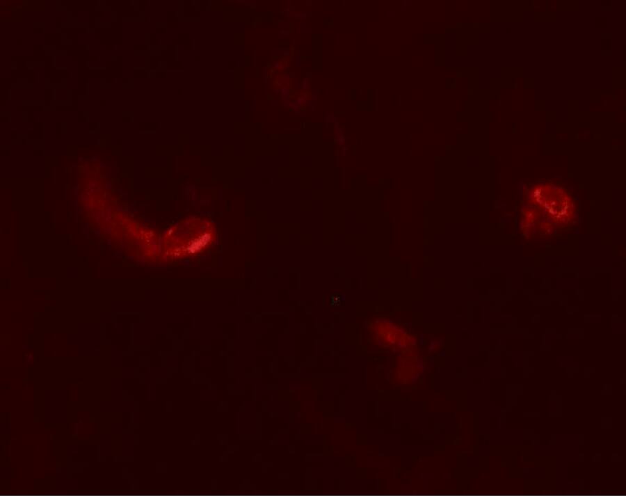 LEMD3 Antibody - BSA Free