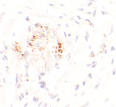 LEMD3 Antibody - BSA Free