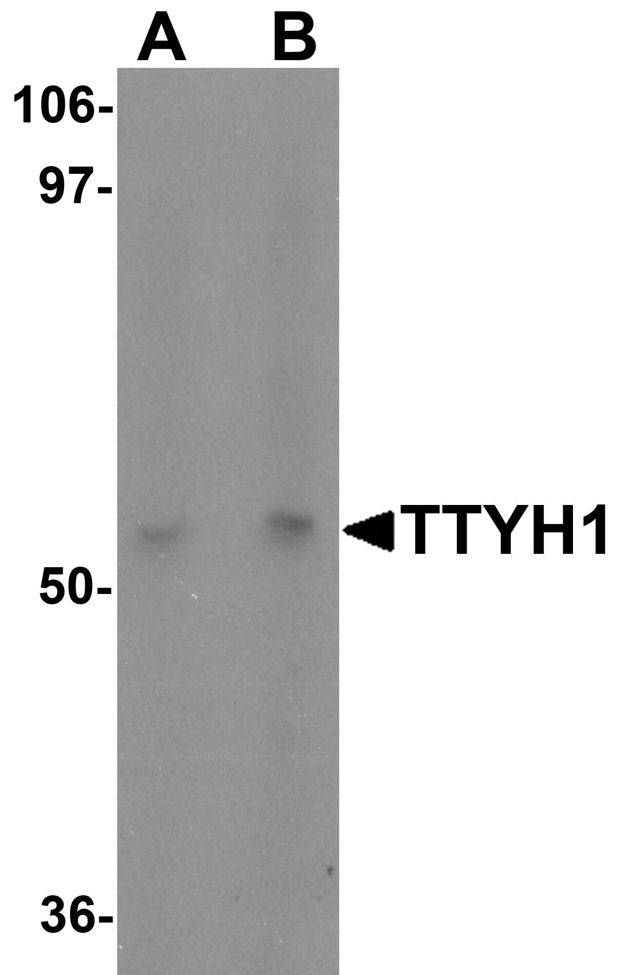 TTYH1 Antibody - BSA Free