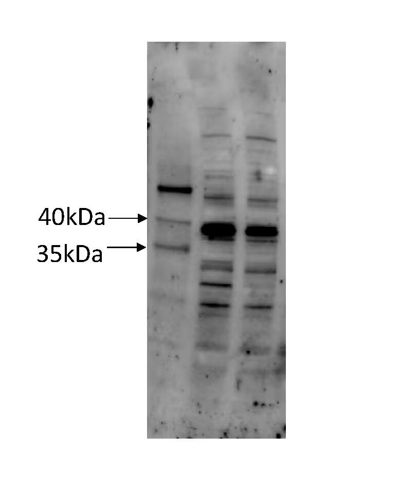 COQ5 Antibody