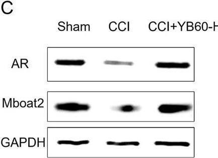MBOAT2 Antibody - BSA Free