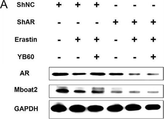 MBOAT2 Antibody - BSA Free