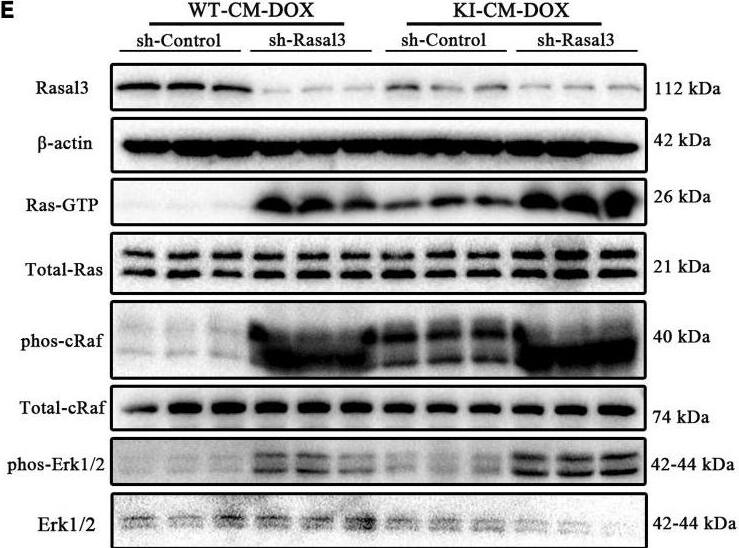 RASAL3 Antibody - BSA Free