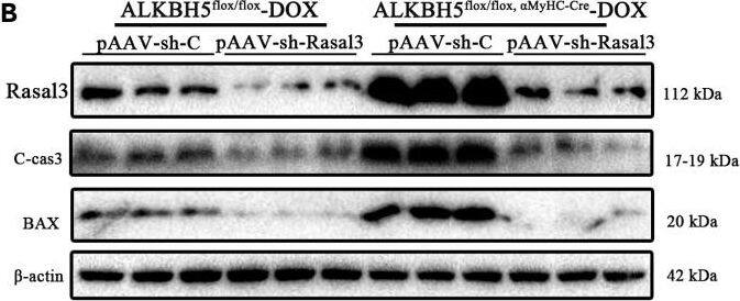 RASAL3 Antibody - BSA Free
