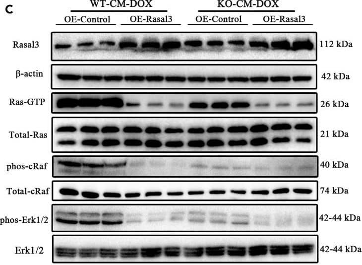 RASAL3 Antibody - BSA Free