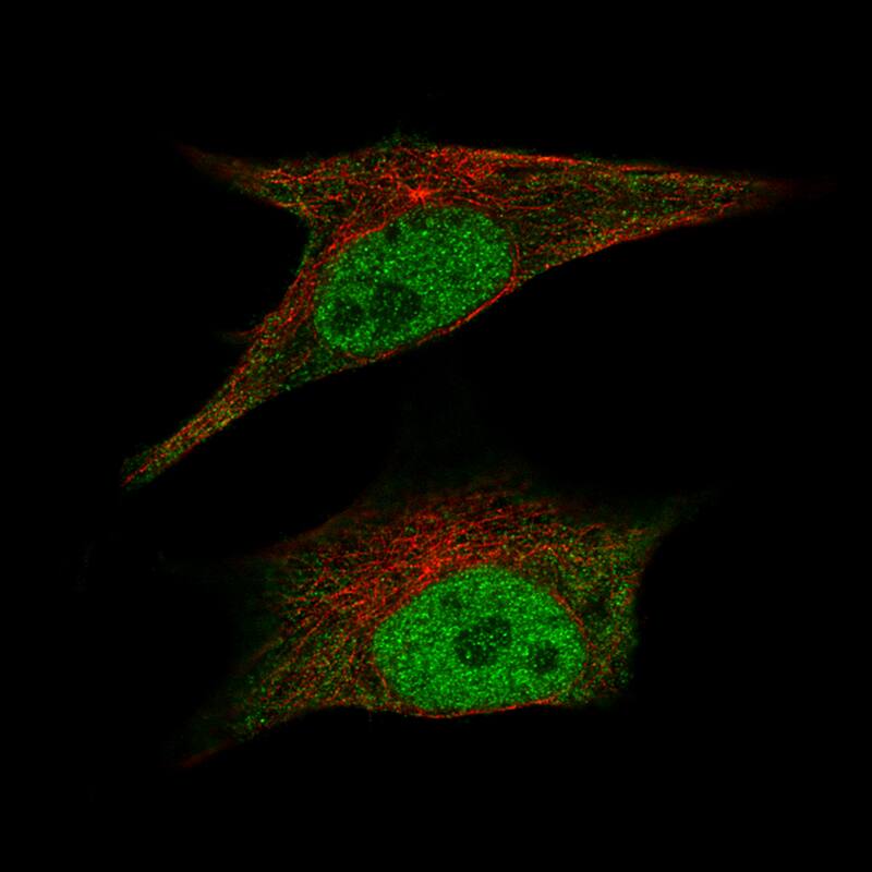 CDK2 Antibody (CL7990) - BSA Free Immunocytochemistry/ Immunofluorescence: CDK2 Antibody (CL7990) - BSA Free[NBP2-88911]