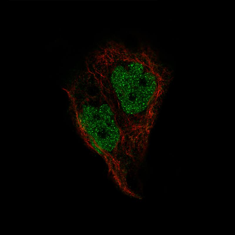Pax2 Antibody (CL9469) - BSA Free Immunocytochemistry/ Immunofluorescence: Pax2 Antibody (CL9469) [NBP2-88934]