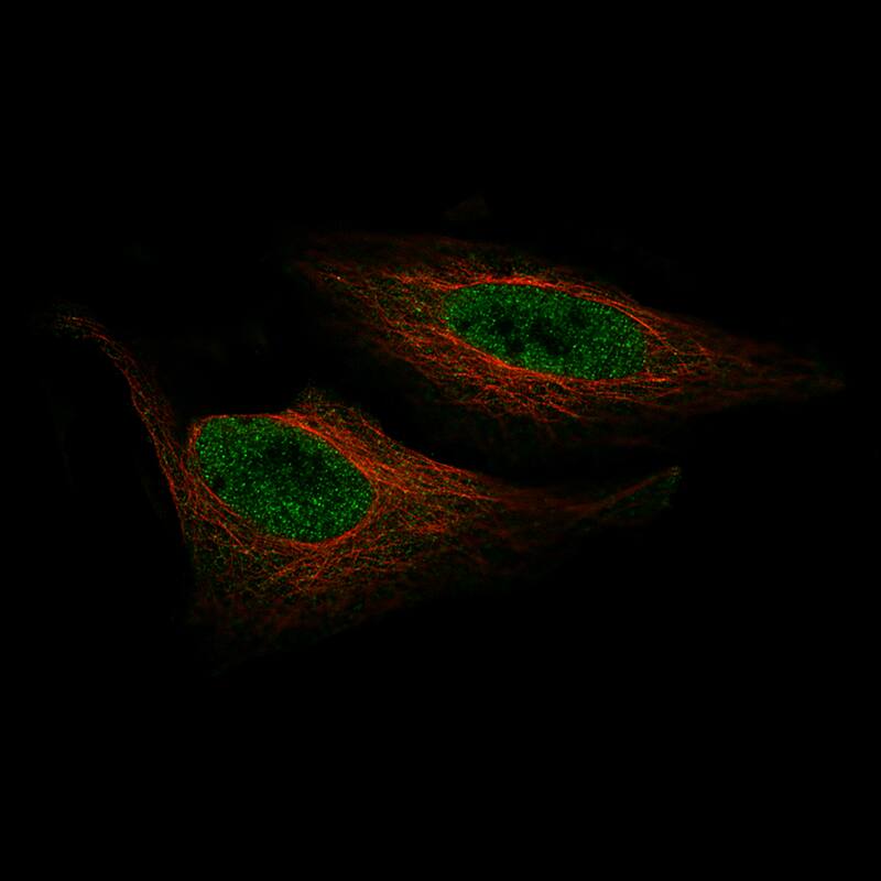 ZNF10 Antibody (CL9744) - BSA Free Immunocytochemistry/ Immunofluorescence: ZNF10 Antibody (CL9744) [NBP2-88939]