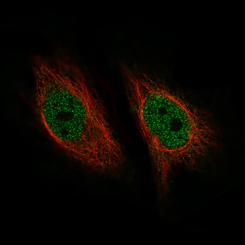 ZNF10 Antibody (CL9747) - BSA Free Immunocytochemistry/ Immunofluorescence: ZNF10 Antibody (CL9747) [NBP2-88940]
