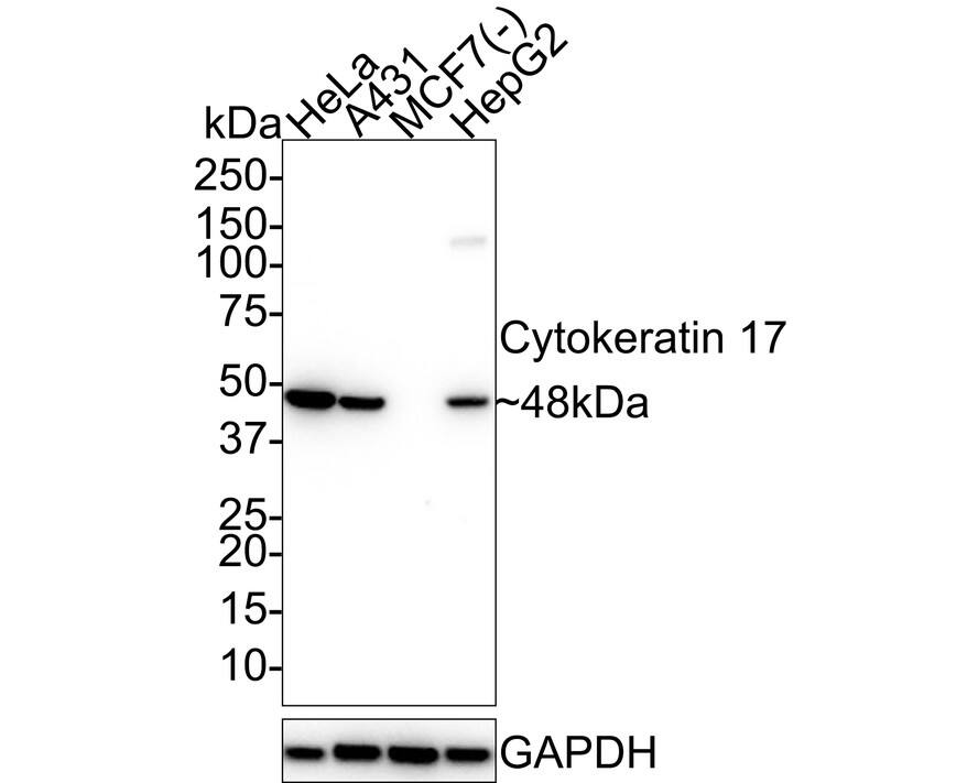 Cytokeratin 17 Antibody (A2B10) Western Blot: Cytokeratin 17 Antibody (A2B10) [NBP2-89123]