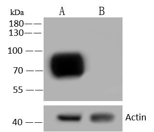 CD155/PVR Antibody (114)