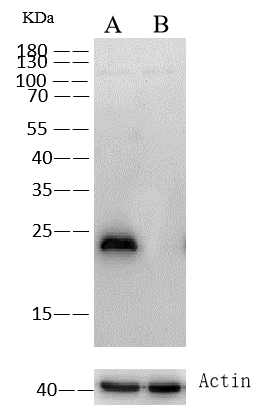 Glutathione S-Transferase pi 1/GSTP1 Antibody (003) Western Blot: Glutathione S-Transferase pi 1/GSTP1 Antibody (003) [NBP2-89323]