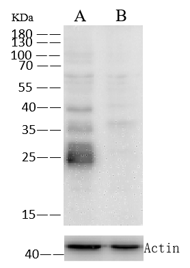 Cathepsin L Antibody (221) Western Blot: Cathepsin L Antibody (221) [NBP2-89528]