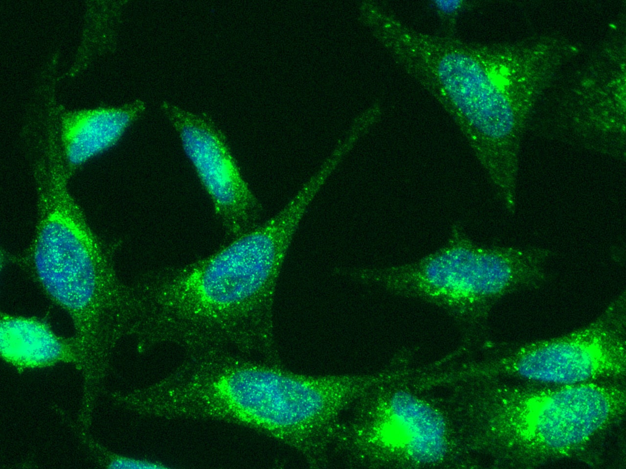 TNF RI/TNFRSF1A Antibody (001) - Azide and BSA Free