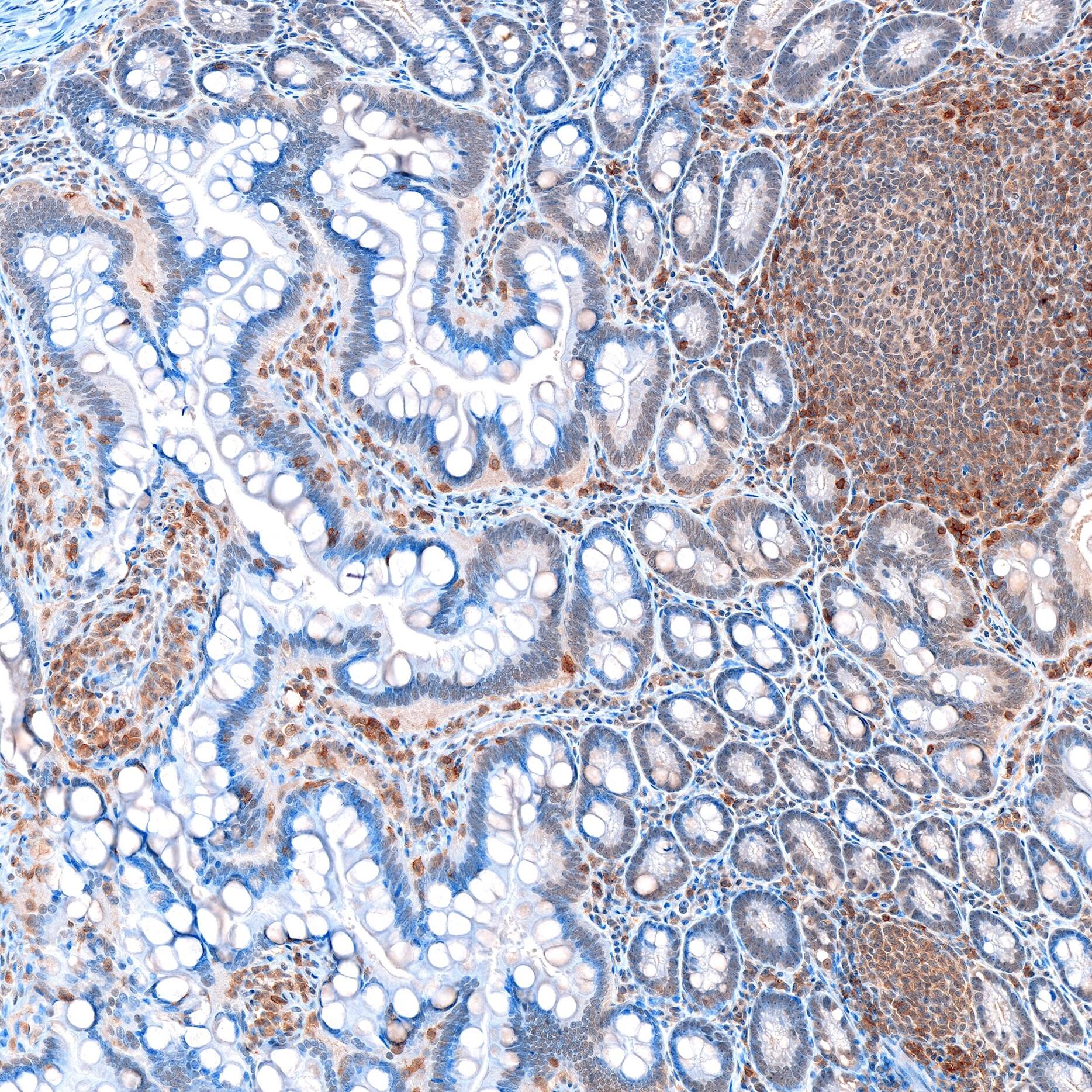 CD8 beta Antibody (039)