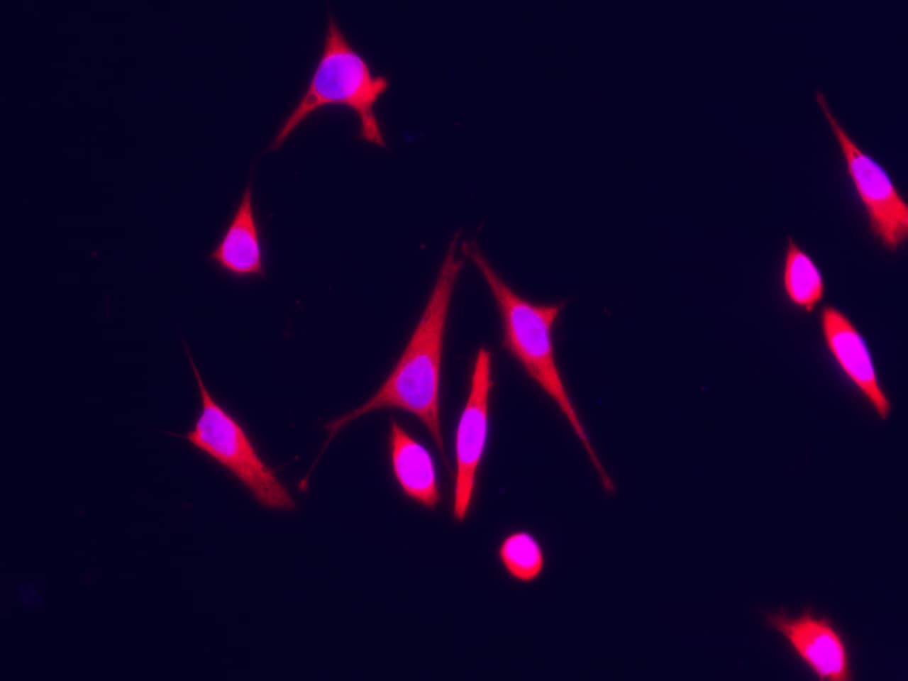 S100A7/Psoriasin Antibody (128) - Azide and BSA Free