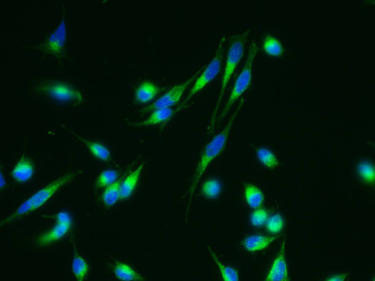 Nicastrin Antibody (004) - Azide and BSA Free
