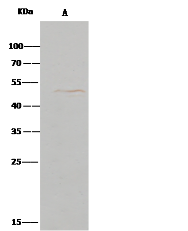 CD39L4/ENTPD5 Antibody (064) - Azide and BSA Free