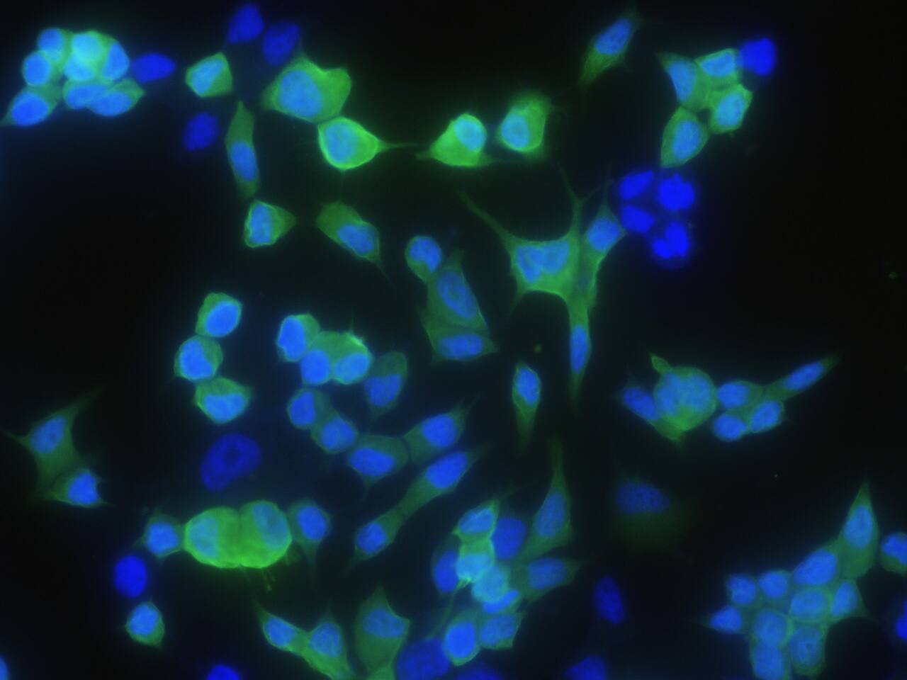 CRABP2 Antibody (004) - Azide and BSA Free
