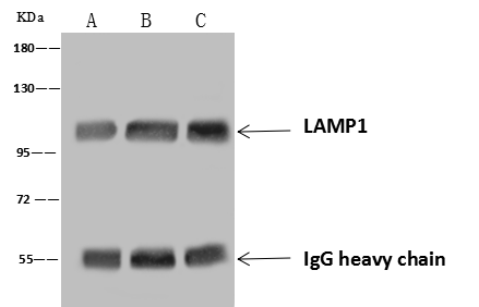LAMP-1/CD107a Antibody (107) Immunoprecipitation: LAMP-1/CD107a Antibody (107) [NBP2-89844]