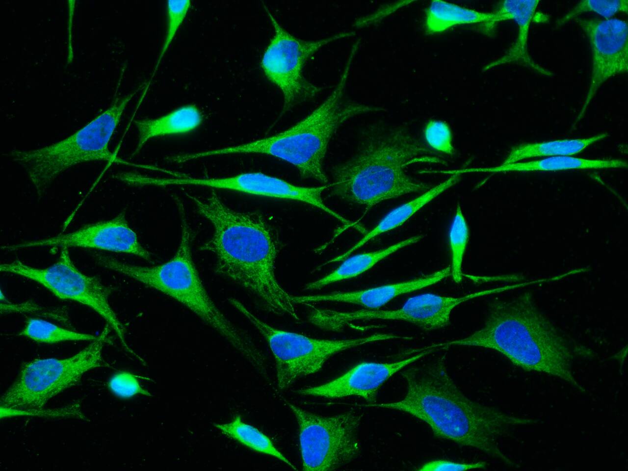 ALDH7A1 Antibody (101) - Azide and BSA Free
