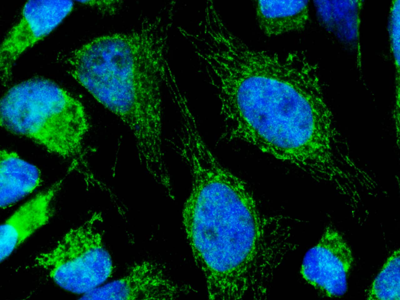 Lumican Antibody (212) - Azide and BSA Free