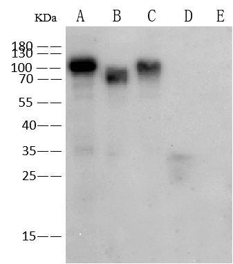 Influenza A H1N1 Hemagglutinin Antibody (107) Western Blot: Influenza A H1N1 Hemagglutinin Antibody (107) [NBP2-89960]