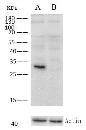 Cathepsin D Antibody (010) Western Blot: Cathepsin D Antibody (010) [NBP2-90119]