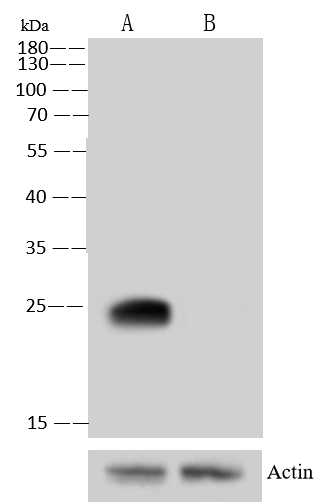 SOD2/Mn-SOD Antibody (001)