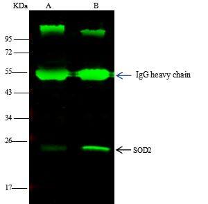 SOD2/Mn-SOD Antibody (001) [NBP2-90138]
