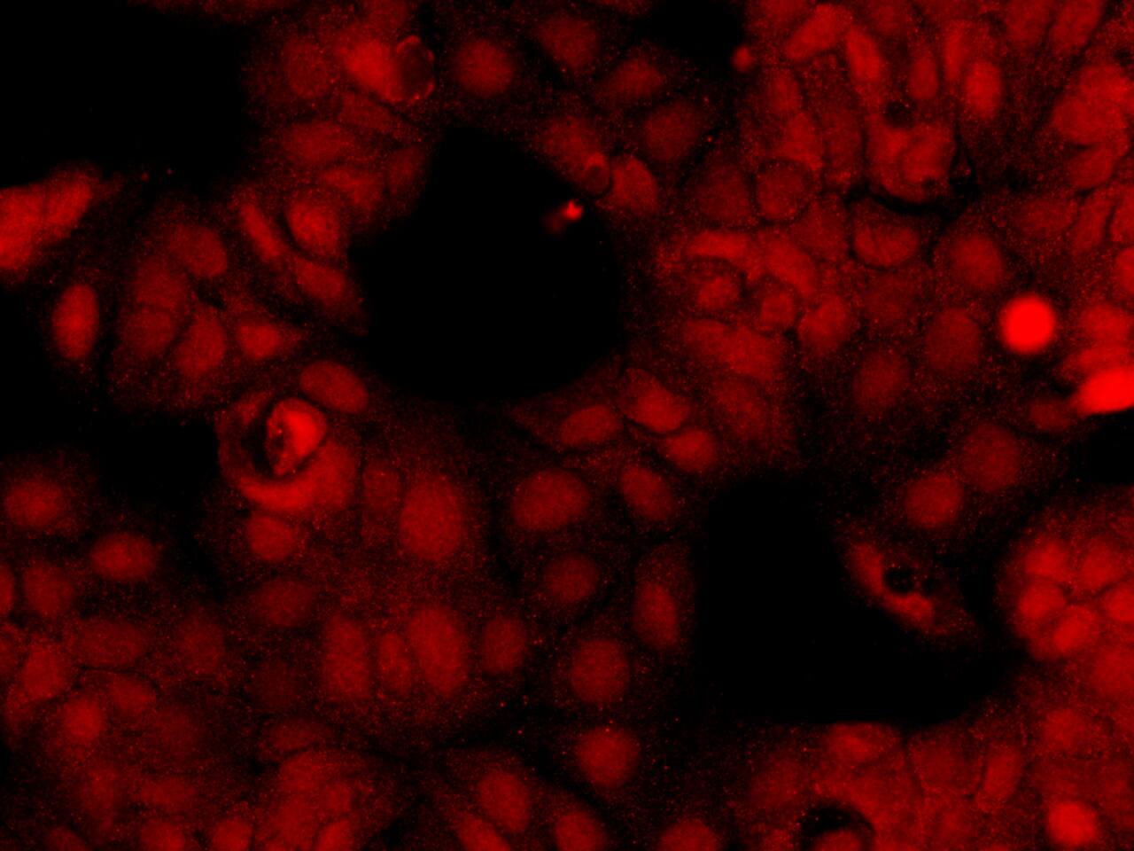Otubain-2 Antibody (139) - Azide and BSA Free
