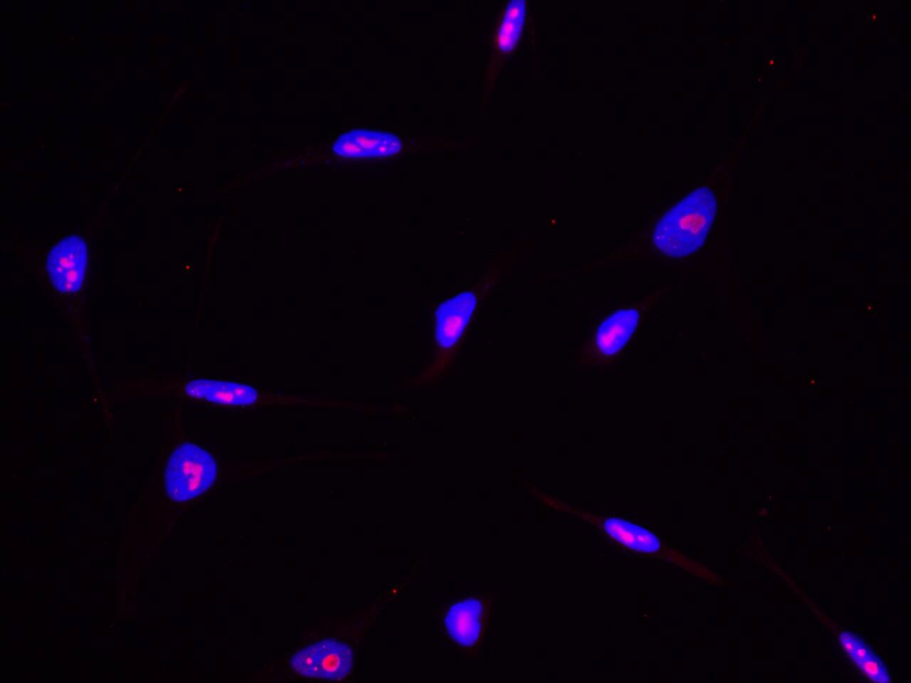 ABHD14B Antibody (002) - Azide and BSA Free