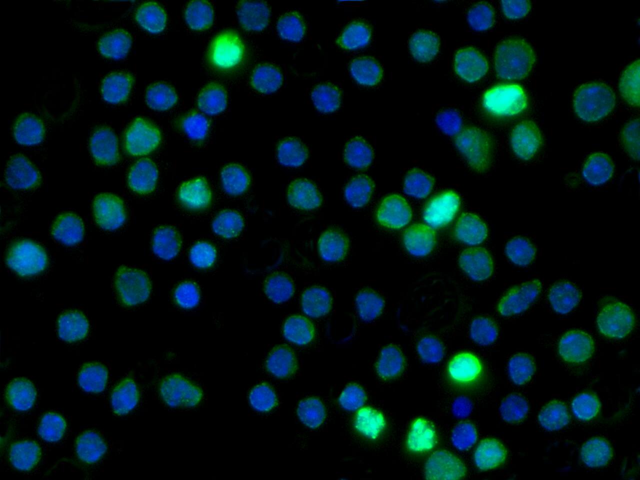RBP4/Retinol-Binding Protein 4 Antibody (008) - Azide and BSA Free