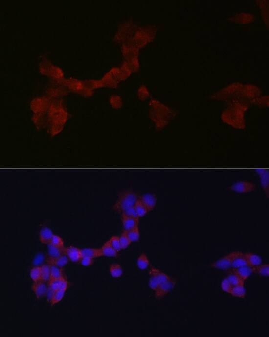 DAB1 Antibody - Azide and BSA Free