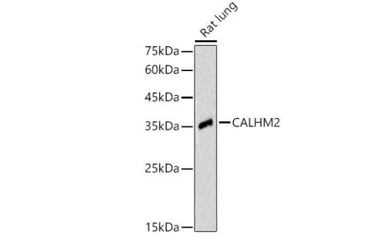 calcium homeostasis modulator 2 Antibody - Azide and BSA Free