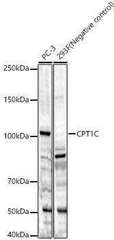 CPT1C Antibody - Azide and BSA Free