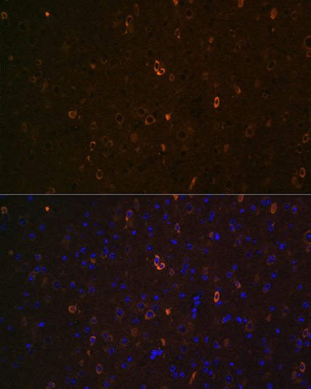 ABCA2 Antibody - Azide and BSA Free