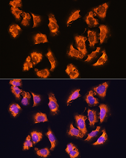 alpha-Sarcoglycan Antibody - Azide and BSA Free