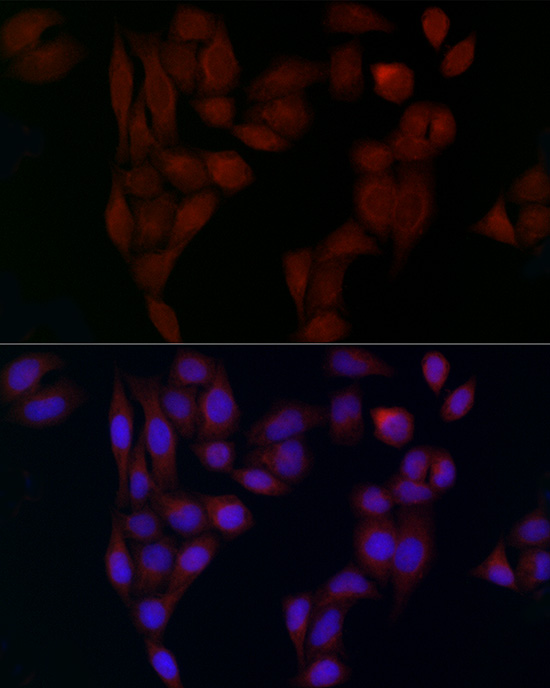AP2A2 Antibody - Azide and BSA Free