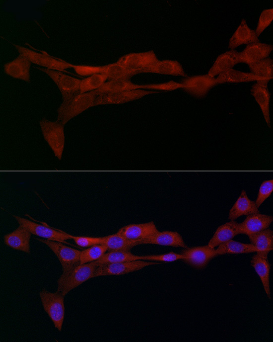 AP2A2 Antibody - Azide and BSA Free