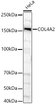 COL4A2 Antibody - BSA Free