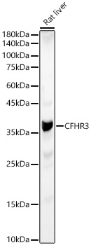 Complement Factor H-related 3/CFHR3 Antibody - BSA Free