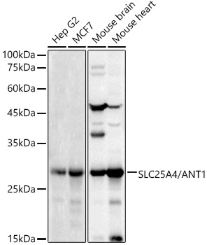 Adenine Nucleotide Translocase 1 Antibody - Azide and BSA Free