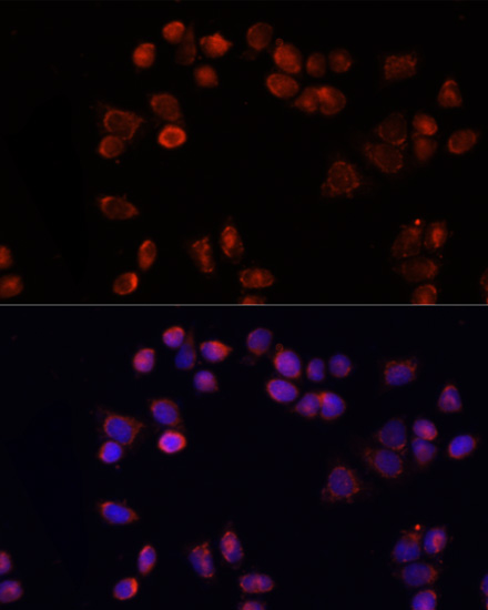 Adenine Nucleotide Translocase 1 Antibody - Azide and BSA Free