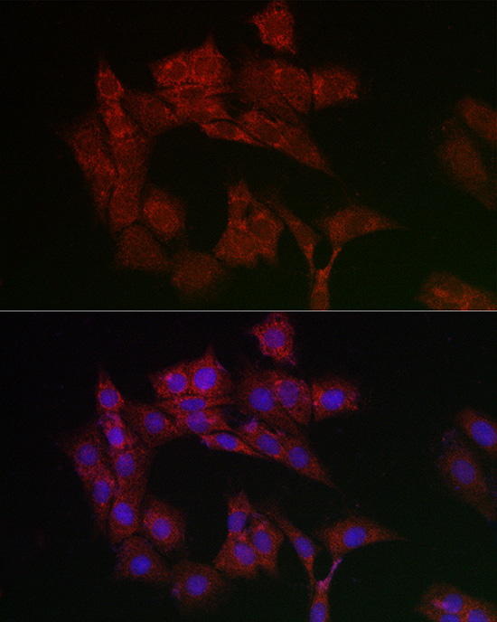Adenine Nucleotide Translocase 1 Antibody - Azide and BSA Free